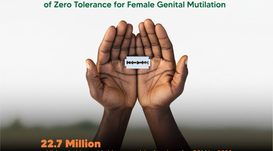FGM